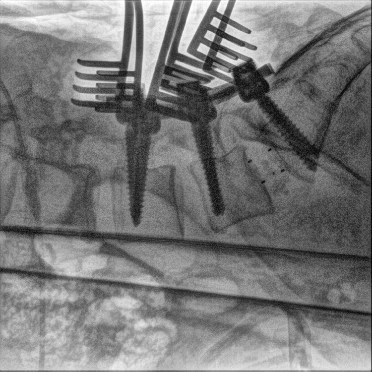 c arm x ray.jpg c arm x ray.jpg
