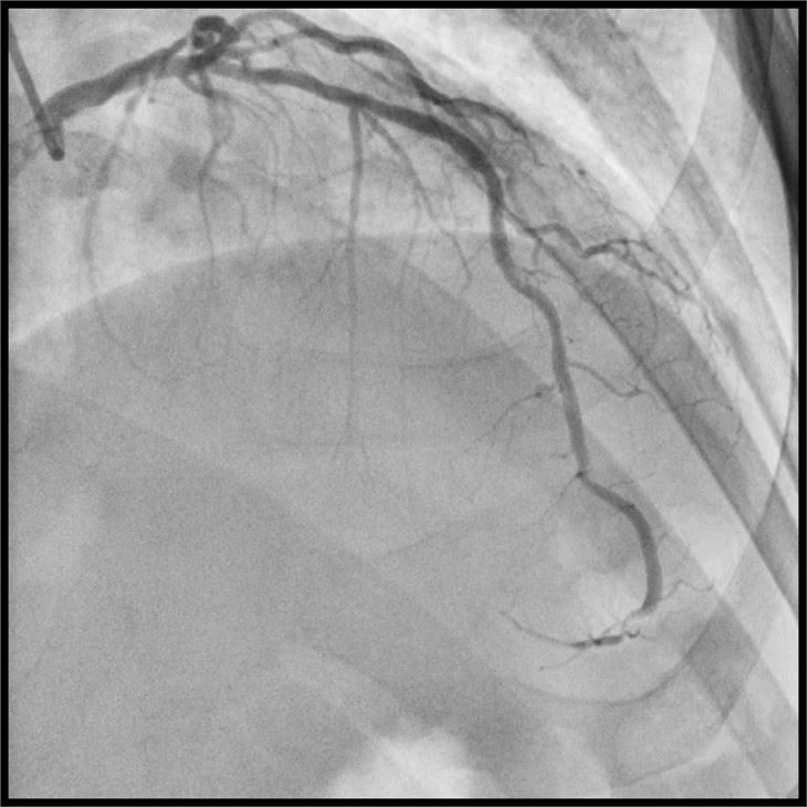 Fixed Cath Lab System