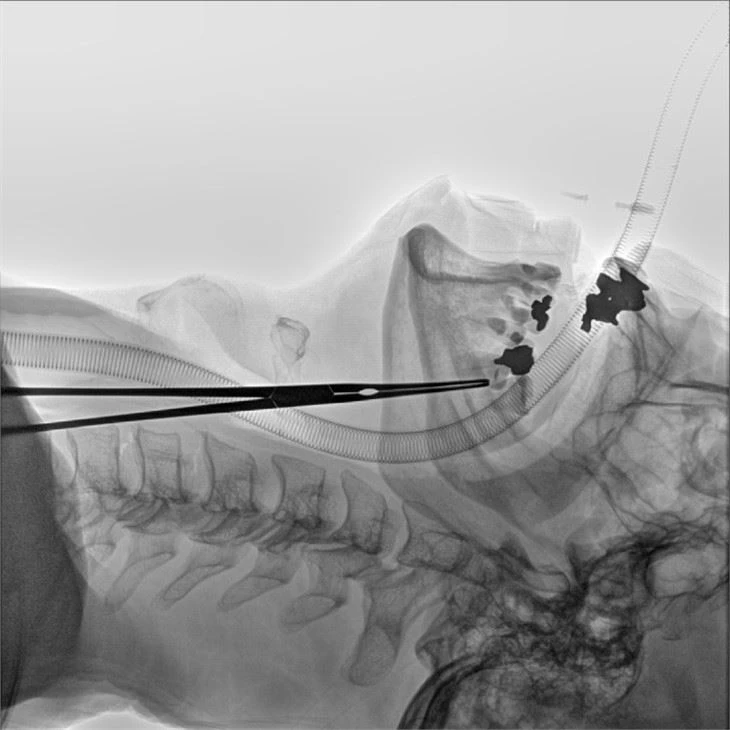 Mobile Digital Angiography System With Dynamic Flat Panel Detector